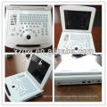 high resolution 3D 4D mini color doppler ultrasound machine DW-500